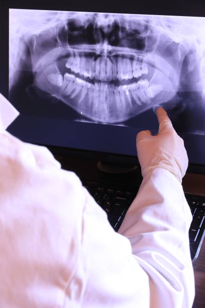 Best Dentist for Tooth Abscess  in Bells, TX
